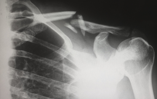 An x-ray of an injury 